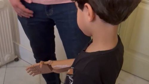 Omar y la primera prótesis 3D que rompe el bloqueo en la Franja de Gaza