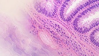 Microsoft desarrolla una IA que aprende el “lenguaje” de la anatomía patológica para detectar cáncer