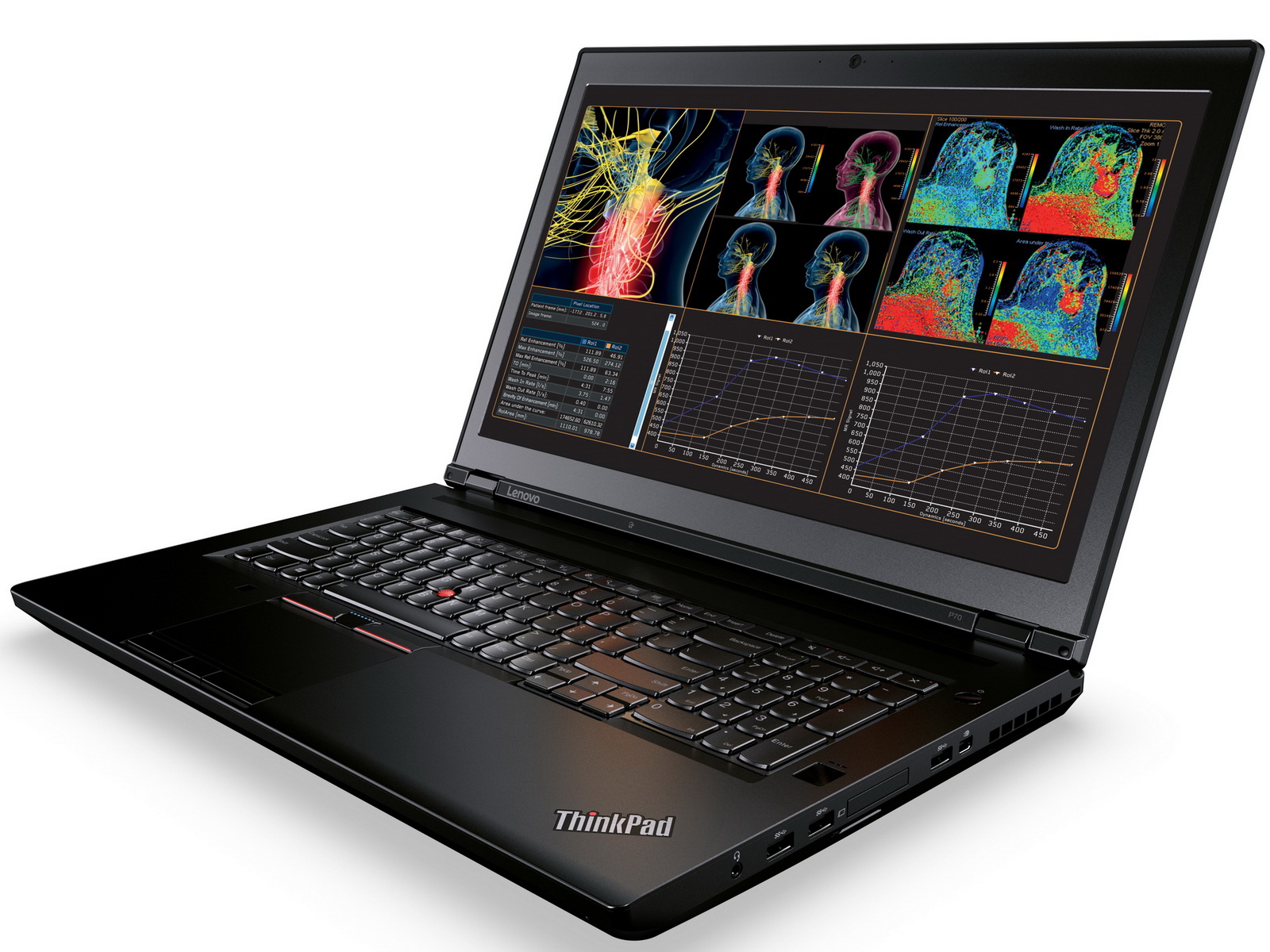 Lenovo anuncia la disponibilidad del nuevo ThinkPad A con tecnología AMD en su tienda online