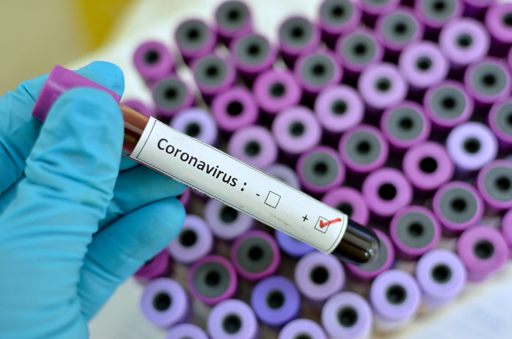 Hay que prepararse para la proxima oleada de Coronavirus