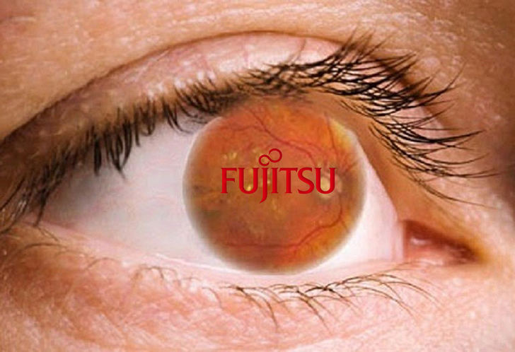 La solución IA de Fujitsu para detectar la retinopatía diabética, la primera causa de ceguera
