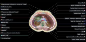 Midjourney lleva su IA al escaneo del cuerpo humano