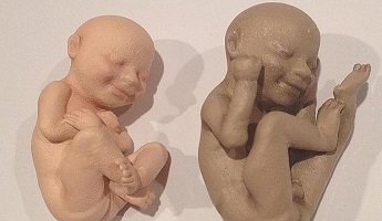 Una `startup´comercializa figuras 3D de los bebés de ecografías