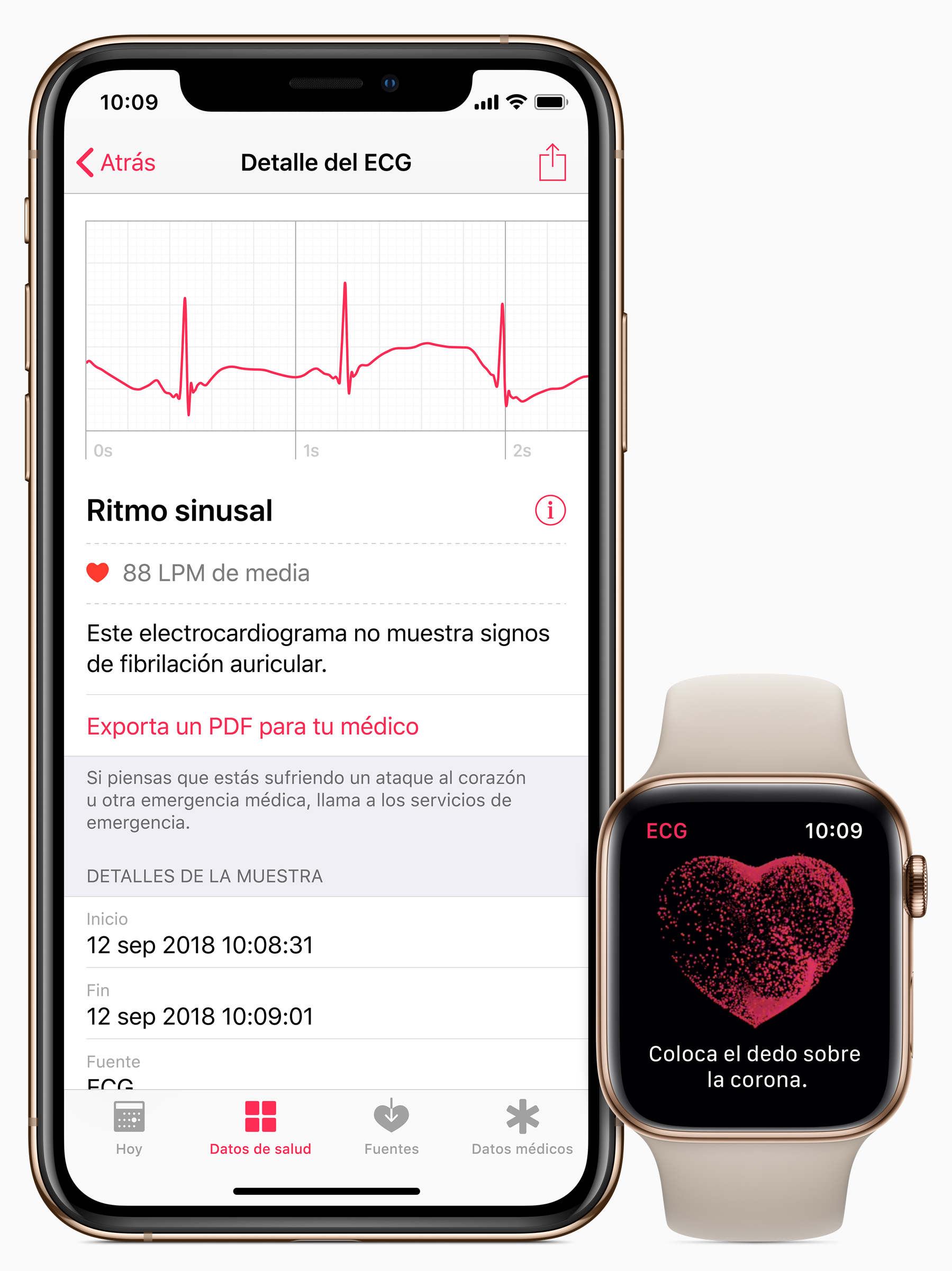 Apple-iphone-watch-ecg-es-es-screen-03272019